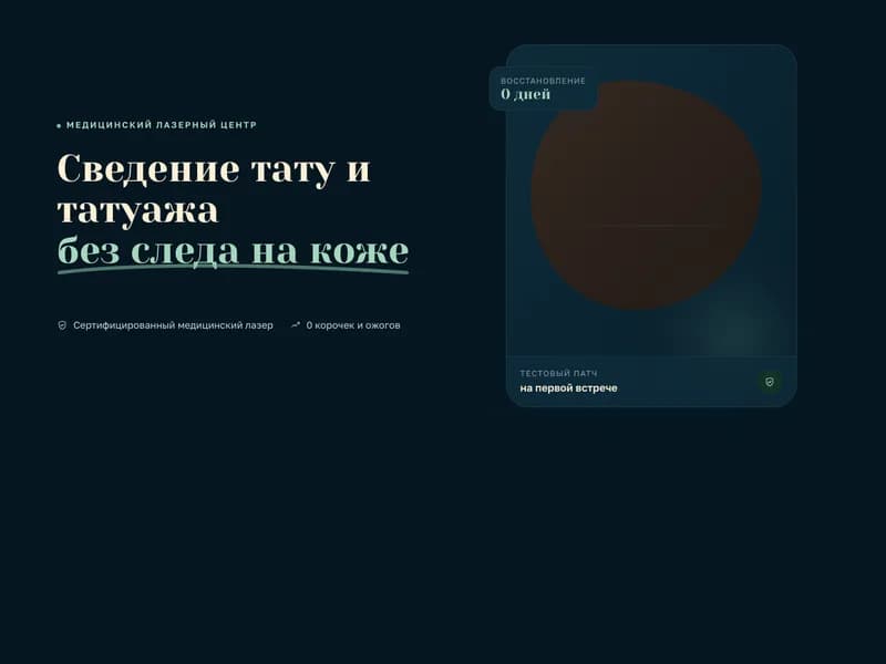 Лазерное сведение тату